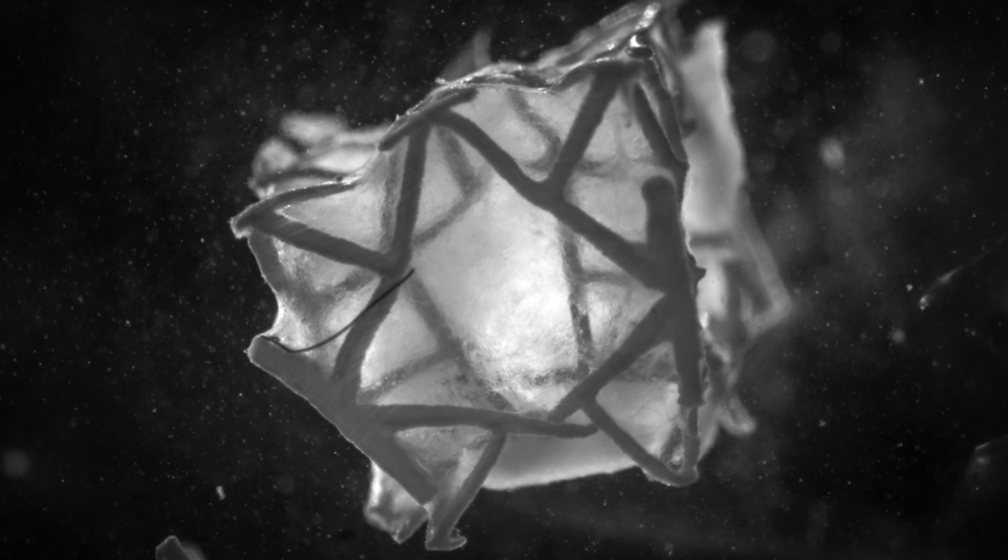 3D-printed cardiac patch engineered to match the mechanical properties of the heart (Image: Soft Robotics Laboratory / ETH Zurich)